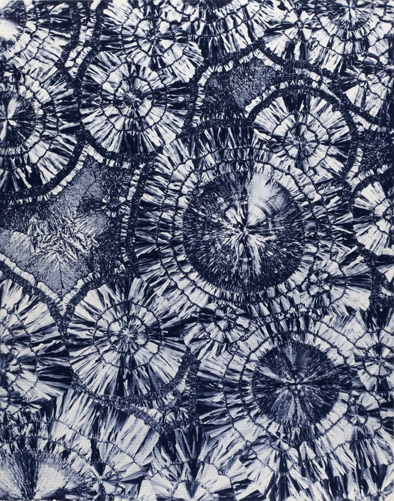 micrography-hippuric-acid-c-1931