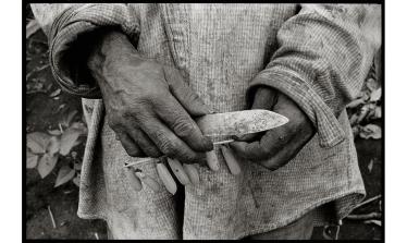 myop_md_mbt_mozambique_19